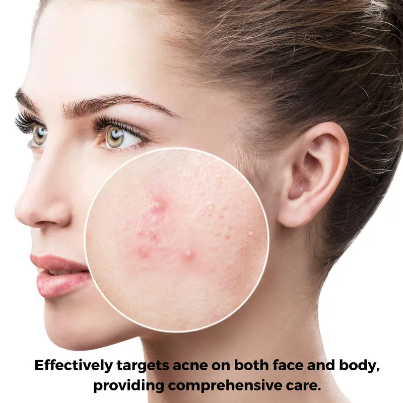 LaClaire Acne Wash & Extra Strength Foaming Cleanser - 50mL