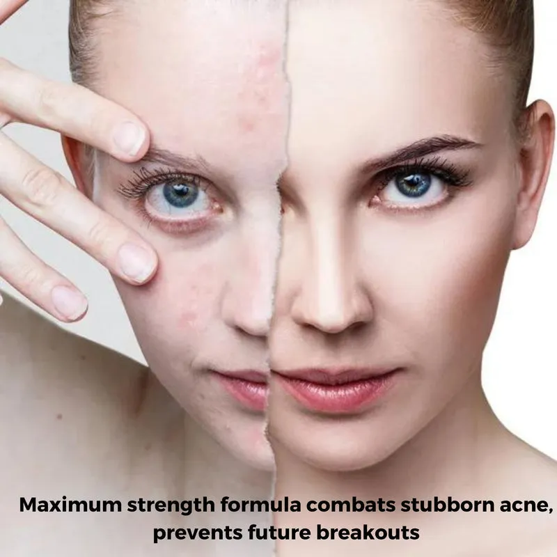 LaClaire Acne Wash & Extra Strength Foaming Cleanser - 50mL